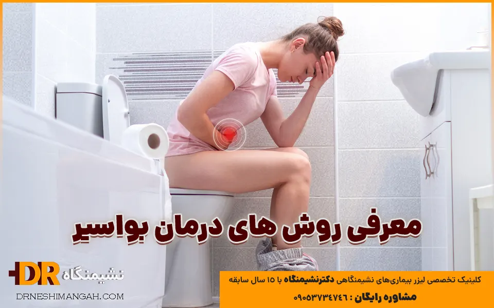 معرفی روش های درمان بواسیر